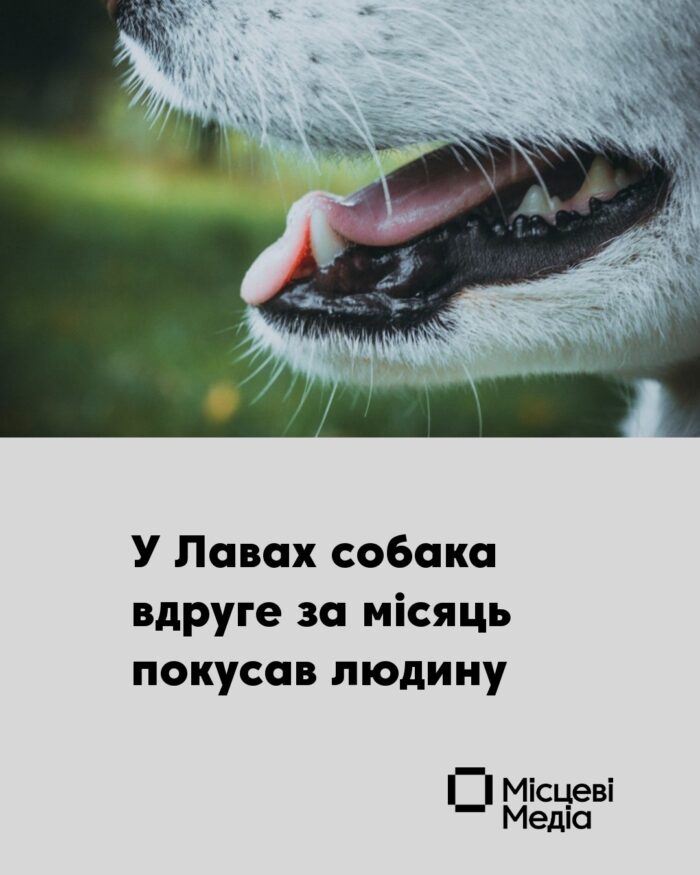 У Сосницькій громаді зафіксовано повторний випадок укусу собакою
